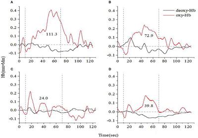 fNIRS Evaluation of Frontal and Temporal Cortex Activation by Verbal Fluency Task and High-Level Cognition Task for Detecting Anxiety and Depression